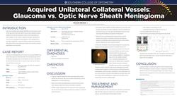 Acquired unilateral collateral vessels: Glaucoma vs Optic nerve sheath meningioma