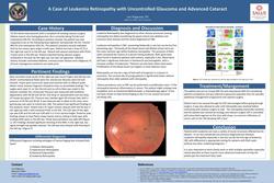 A case of Leukemia Retinopathy in a patient with uncontrolled glaucoma and an advanced cataract