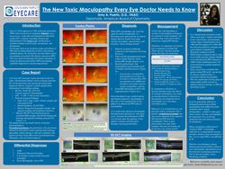 The New Toxic Maculopathy Every Eye Doctor Needs to Know
