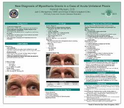 New Diagnosis of Myasthenia Gravis in a Case of Acute Unilateral Ptosis