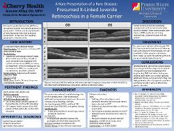 A Rare Presentation of a Rare Disease: Presumed X-Linked Juvenile Retinoschisis in a Female Carrier