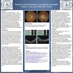Diagnosis and Management of Serpiginous Choroiditis