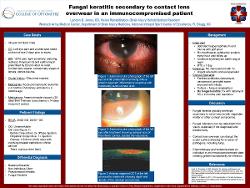 Fungal keratitis secondary to contact lens overwear in an immunocompromised patient