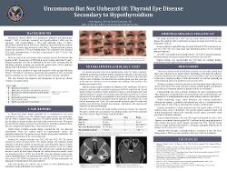 Uncommon, But Not Unheard Of: Thyroid Eye Disease Secondary to Hypothyroidism