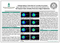 Orthokeratology: A Modality for Correction Free Vision