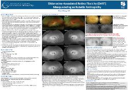 Didanosine-Induced Retinopathy Masquerading as Rubella Retinopathy