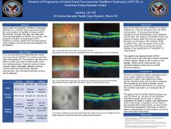 Timeline of Progression of Adult-Onset Foveomacular Vitelliform Dystrophy (AOFVD) in American Indian/Alaskan Indian