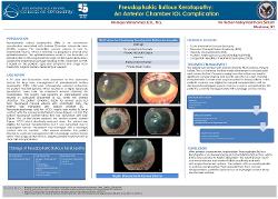 Pseudophakic Bullous Keratopathy: Anterior Chamber IOL complication