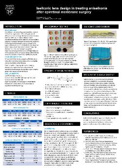 Iseikonic lens design in treating aniseikonia after epiretinal membrane surgery
