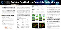 Pediatric Pars Planitis: A Snowglobe in the Vitreous
