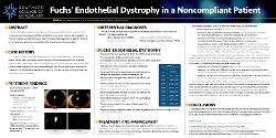 Fuchs’ Endothelial Dystrophy in a Non-compliant Patient