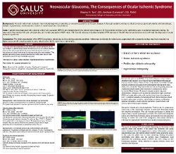 Neovascular Glaucoma, The Consequences of Ocular Ischemic Syndrome