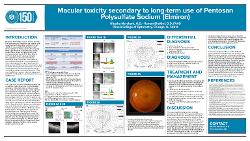 Macular toxicity secondary to long-term use of Pentosan Polysulfate Sodium (Elmiron)