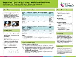 Low Vision Aids After Removal of Dense Bilateral Congenital Cataracts
