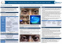 Sequential bilateral dupilumab-associated limbitis in a patient with atopic dermatitis