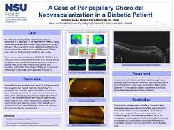 A Case of Peripapillary Choroidal Neovascularization in a Diabetic Patient