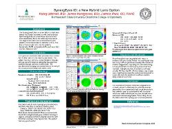SynergEyes iD: a New Hybrid Lens Option