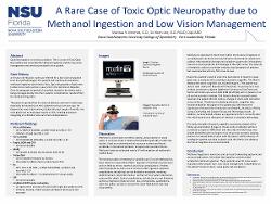 A Rare Case of Toxic Optic Neuropathy due to Methanol Ingestion and Low Vision Management