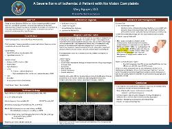 A Severe Form of Ischemia: A Patient with No Vision Complaints