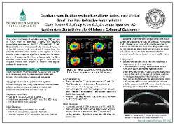 Quadrant-specific Changes in a Scleral Lens to Decrease Limbal Touch in a Post Refractive Surgery Patient