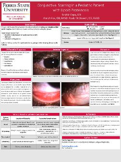 Conjunctival Scarring in a Pediatric Patient with Lipoid Proteinosis