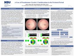 A Case of Pseudotumor Cerebri: Considerations in the Perinatal Period