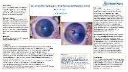 Congenital Iris Cyst causing Deprivation Amblyopia in Infant