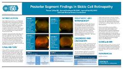 Posterior Segment Findings in Sickle Cell Retinopathy
