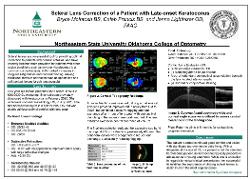 Scleral Lens Correction of a Patient with Late-onset Keratoconus