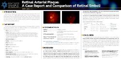 Retinal Arterial Plaque: A Case Report and Comparison of Retinal Emboli