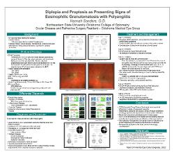 Diplopia and Proptosis as Presenting Signs of Eosinophilic Granulomatosis with Polyangiitis