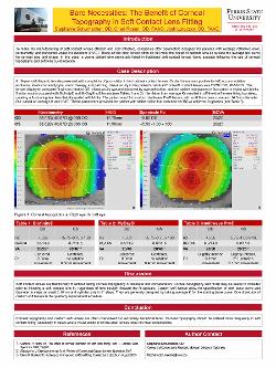 Bare Necessities: The Benefit of Corneal Topography in Soft Contact Lens Fitting