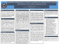 Ophthalmic Manifestations of Chronic Lymphocytic Leukemia (CLL): a review of the blood cancers with an emphasis on CLL