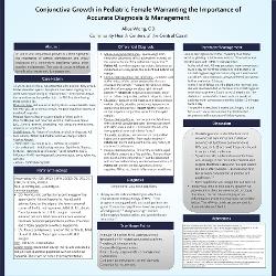 Conjunctiva Growth in Pediatric Female Warranting Importance of Accurate Diagnosis and Management