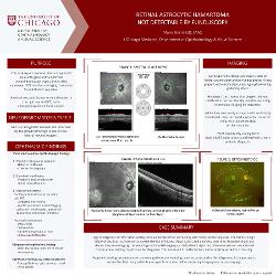 Retinal Astrocytic Hamartoma Not Detectable by Fundoscopy