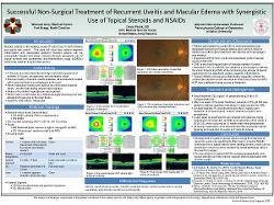 Successful Non-Surgical Treatment of Recurrent Uveitis and Macular Edema with Synergistic Use of Topical Steroids and NSAIDs.