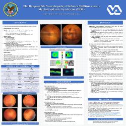 The Responsible Vasculopathy: Diabetes Mellitus versus Myelodysplastic Syndrome