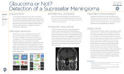 Glaucoma or Not? Detection of a Suprasellar Meningioma