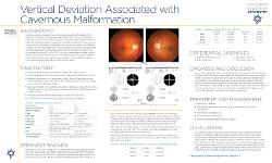 Vertical Deviation Associated with Cavernous Malformation