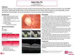 Optic Disc Pit with Associated Maculopathy