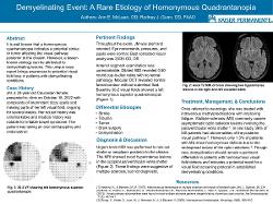 Demyelinating Event: A Rare Etiology of Homonymous Quadrantanopia