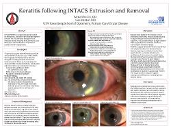Keratitis following INTACS Extrusion and Removal