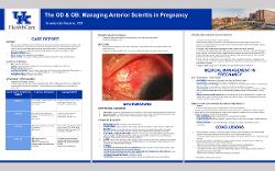 The OD & OB: Managing Anterior Scleritis in Pregnancy