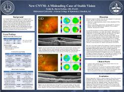 New CNVM: A Misleading Case of Stable Vision