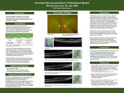 Choroidal Neovascularization in Pathological Myopia