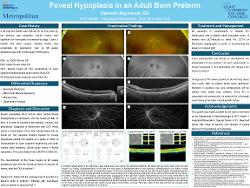 Foveal Hypoplasia in an Adult Born Preterm