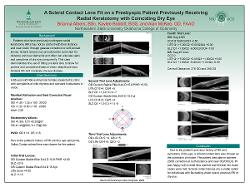 A Scleral Contact Lens Fit on a Presbyopic Patient Previously Receiving Radial Keratotomy with Coinciding Dry Eye