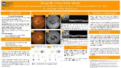 Stargardt: House of the Macula