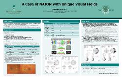 A Case of NAION With Unique Visual Fields