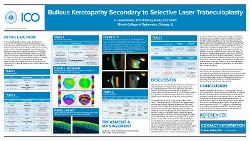 Bullous Keratopathy Secondary to Selective Laser Trabeculoplasty